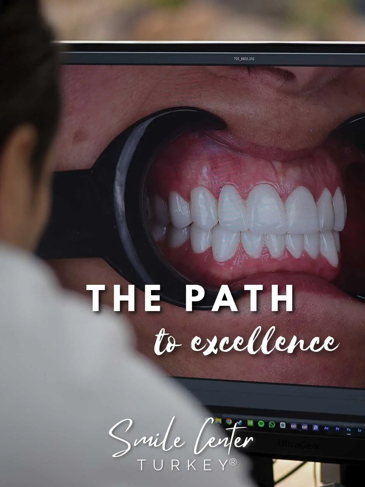 Clinician reviewing high-resolution dental photography on screen during smile design at Smile Center Turkey®